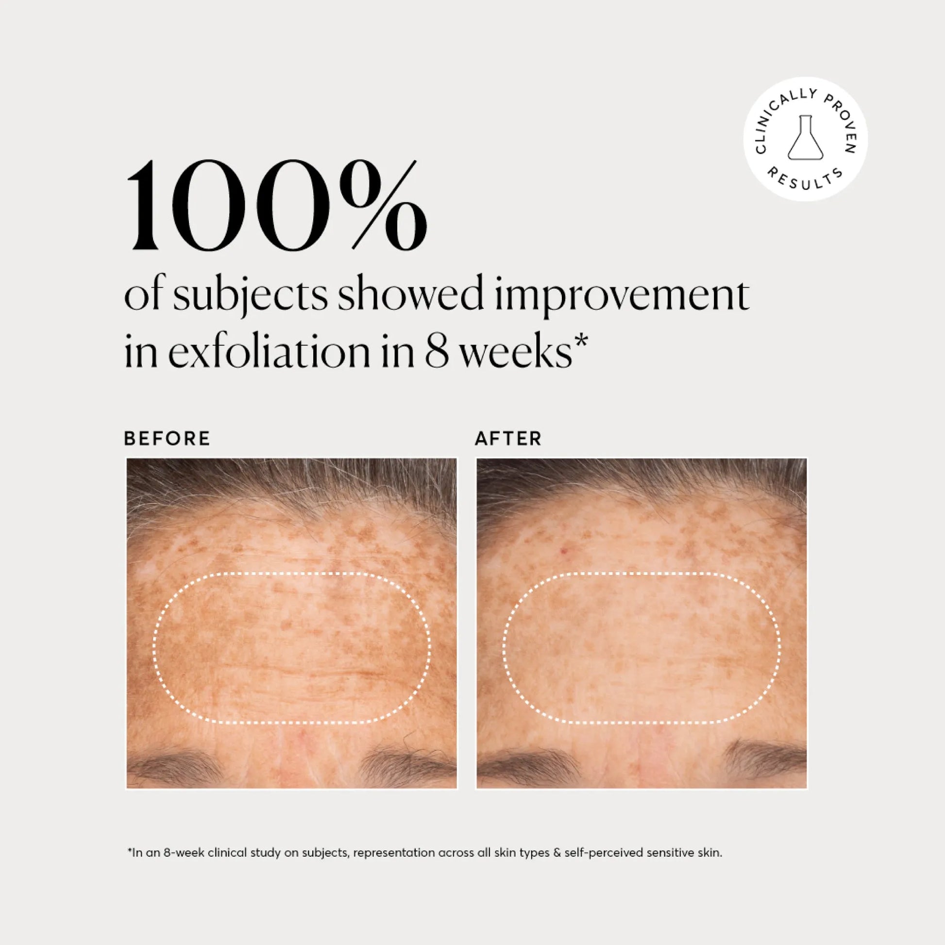 bha-liquid-exfoliant-2-a6 NATR-10027-Alt-Images-BHA-Liquid-Exfoliant-2_-03.webp