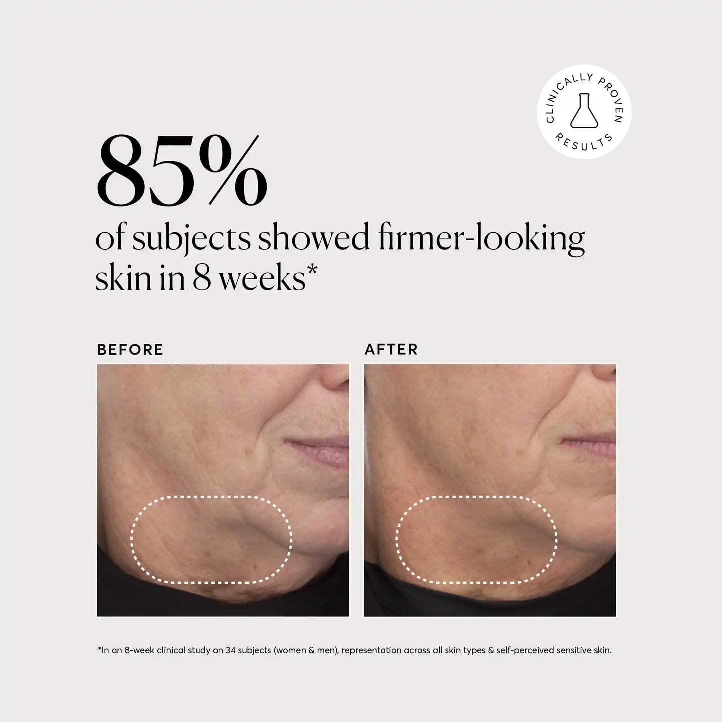 retinol-complex-serum-o0 NATR-10034-Alt-Images-Retinol-Complex-Serum-04.webp